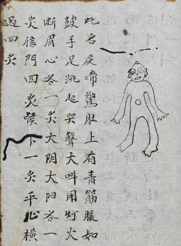 惊症火式.pdf